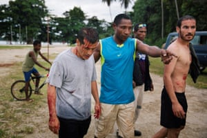 Injured refugees from the Australian-funded Manus Island detention centre in Lorengau after an alleged attack by a group of Papua New Guinean men.