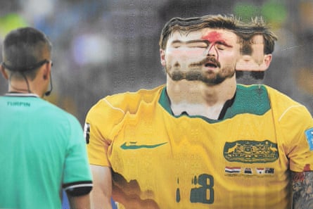 A bloodied Connor Metcalfe. Original photograph by Stu Forster.