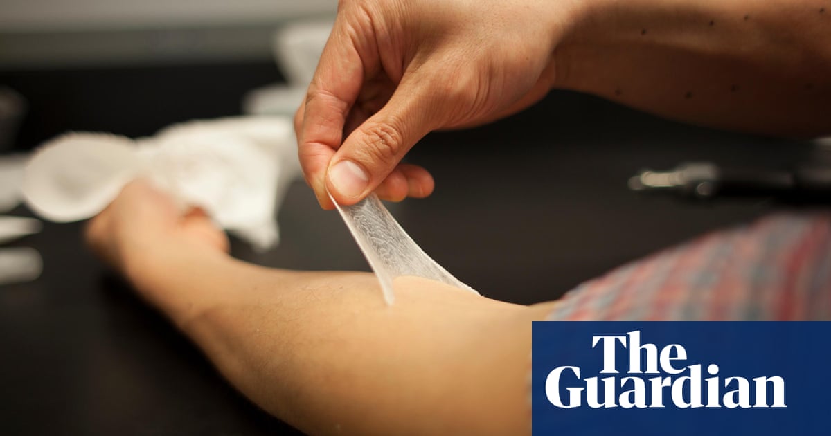 Stretchy Second Skin Could Make Wrinkles A Thing Of The Past Ageing The Guardian Stretchy Second Skin Could Make Wrinkles A Thing Of The Past Ageing The Guardian