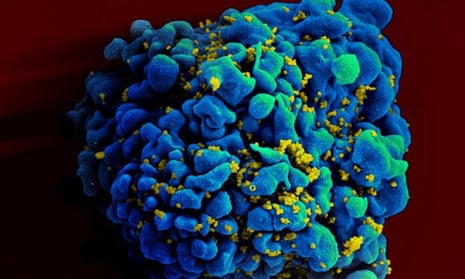 A (blue) H9 T cell infected with the (yellow) human immunodeficiency virus