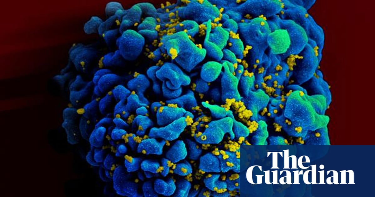 End to Aids in sight as huge study finds drugs stop HIV transmission thumbnail