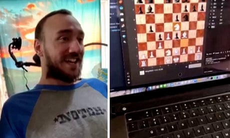 Neuralink’s First Implant Partly Removed from Patient’s Brain Neuralink patient Noland Arbaugh uses a brain-chip to play chess on his computer