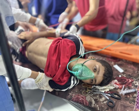 Medical staff at the Kuwaiti Field hospital provide treatment to a wounded child brought in after an Israeli airstrike hit tents sheltering displaced Palestinians in the Mevasi area of Khan Younis, Gaza Strip, on Wednesday, 27 August 2025.