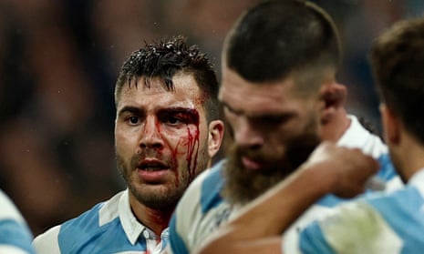 Argentina's Facundo Isa with a bloodied face
