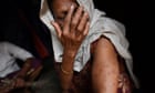 Accountability is the only way to end violence in Myanmar