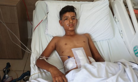 A teenage boy lays in a hospital bed connected to machines