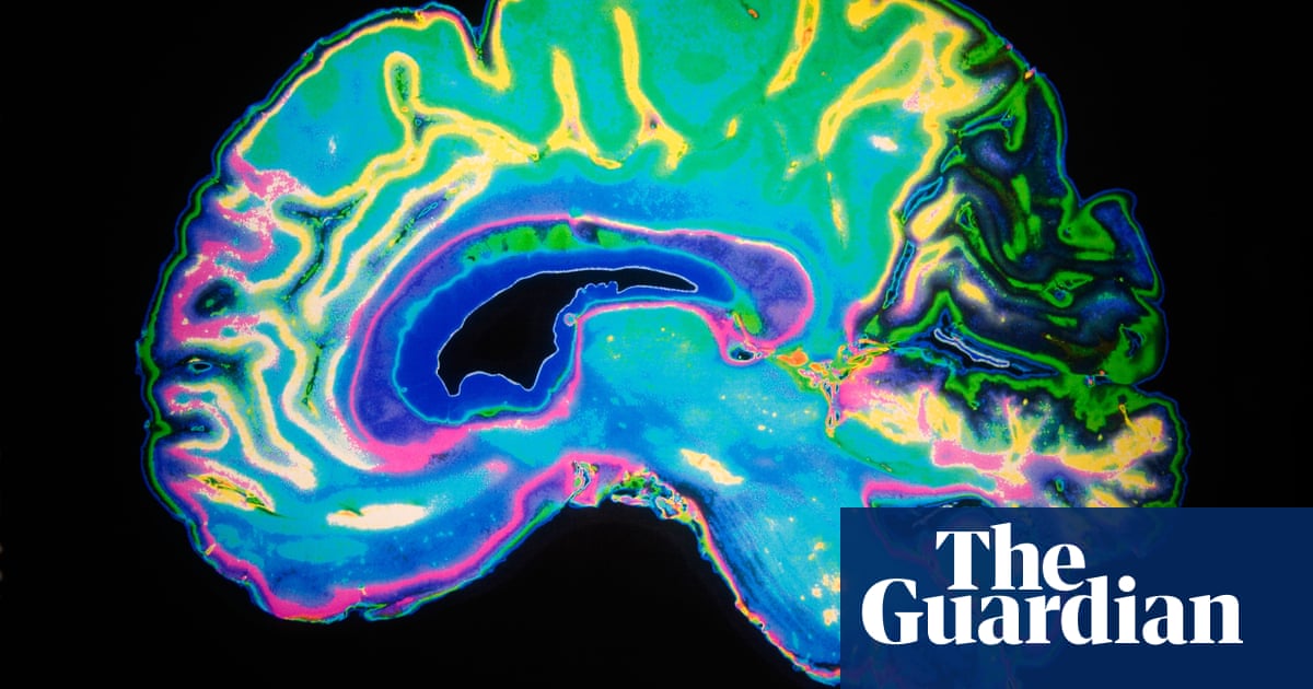 Warning of serious brain disorders in people with mild Covid symptoms - The Guardian