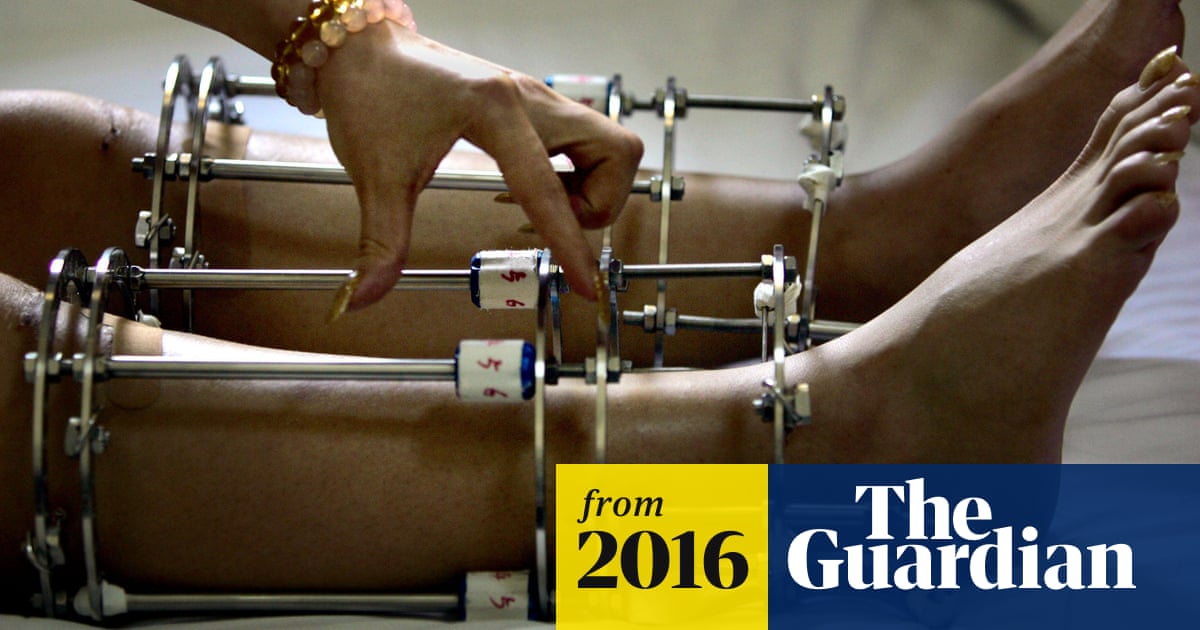 I Have To Be Taller The Unregulated World Of India S Limb