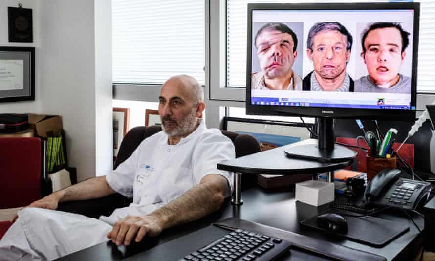 French medicine professor Laurent Lantieri poses next to a screen showing different steps of his patient Jérôme Hamon’s surgery.