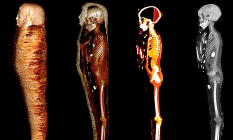 CT scans of a mummy