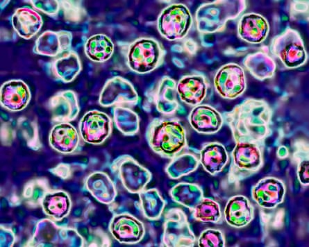 Measles nether a microscope