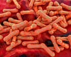Diphtheria is a disease of poverty that has no place in modern Australia. When we talk about Closing the Gap, this is the gap | Donna Ah Chee