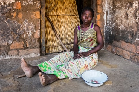 Malawian mother Alufufasi Yalu, who has nothing to eat