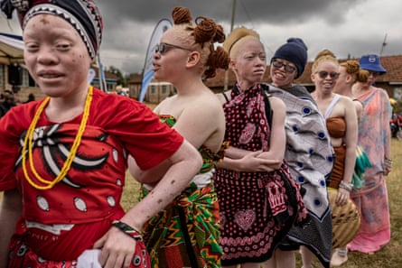 Seven African girls with albinism wearing bright traditional clothing stand in a line. Several wear dark glasses