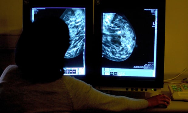 A consultant studies a mammogram.