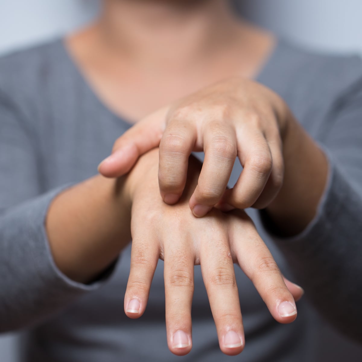 Everything You Ve Ever Wanted To Know About Eczema But Were Too Busy Scratching To Ask Health Wellbeing The Guardian Everything You Ve Ever Wanted To Know About Eczema But Were Too Busy Scratching To Ask Health Wellbeing The Guardian