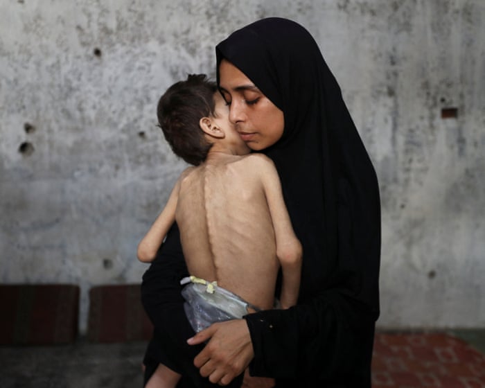 Famine under way in Gaza, UN-backed experts say | First Thing