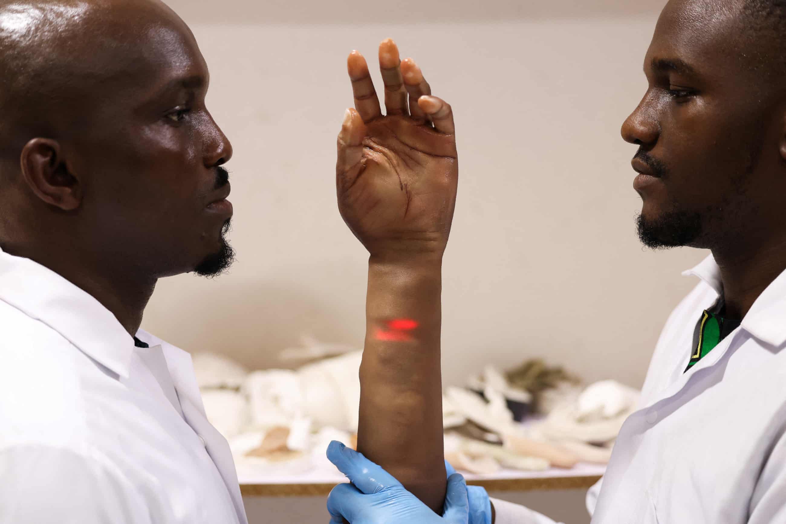 'Prosthetics aren't made for people like us': the brothers creating innovative artificial limbs for Africans