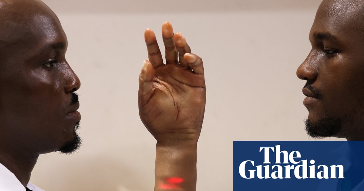 ‘Prosthetics aren’t made for people like us’: the brothers creating innovative artificial limbs for Africans