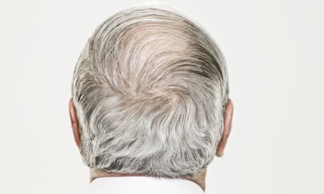 Rear view of a balding senior man.