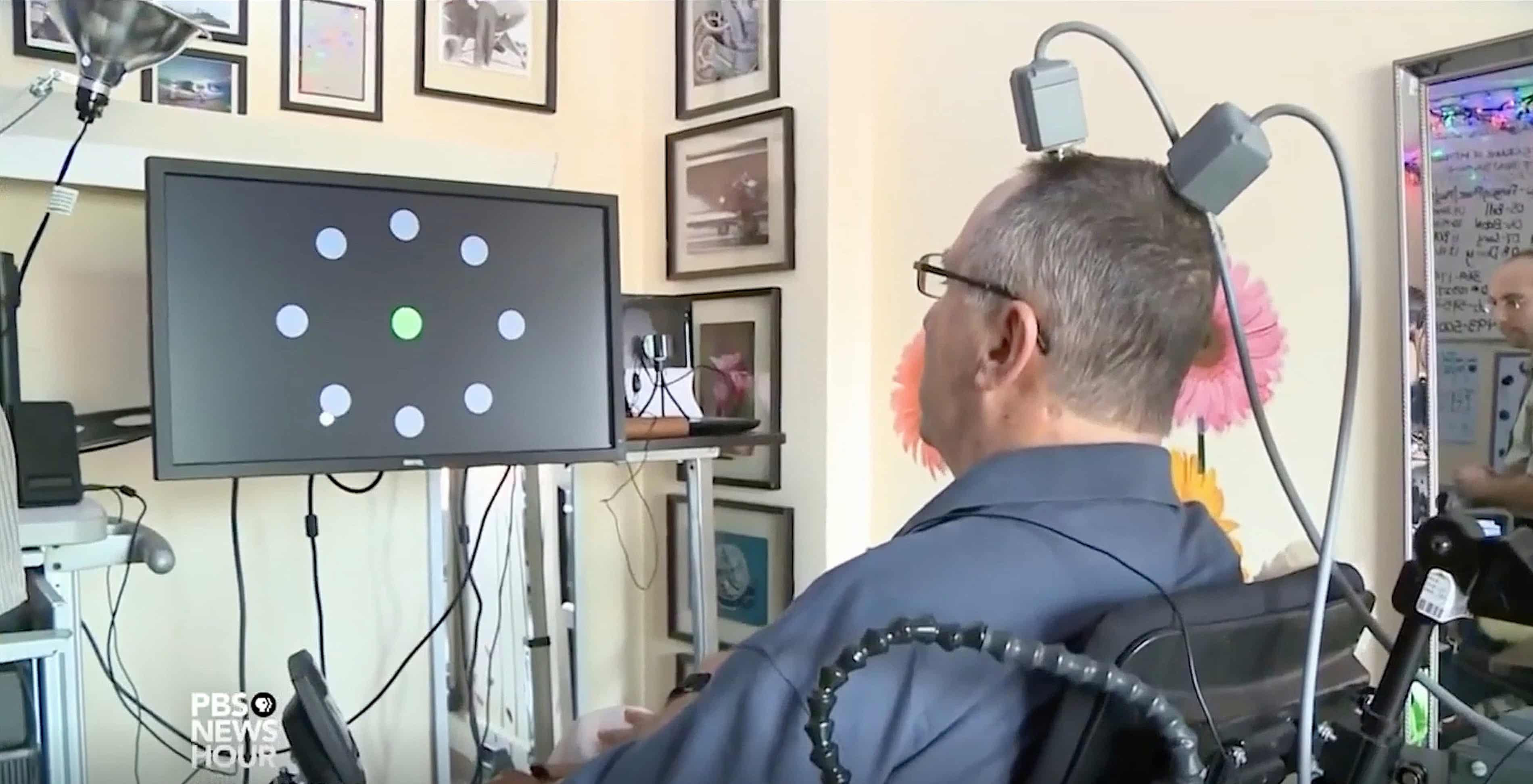 Neuralink rival sets brain-chip record with 4,096 electrodes on human ...
