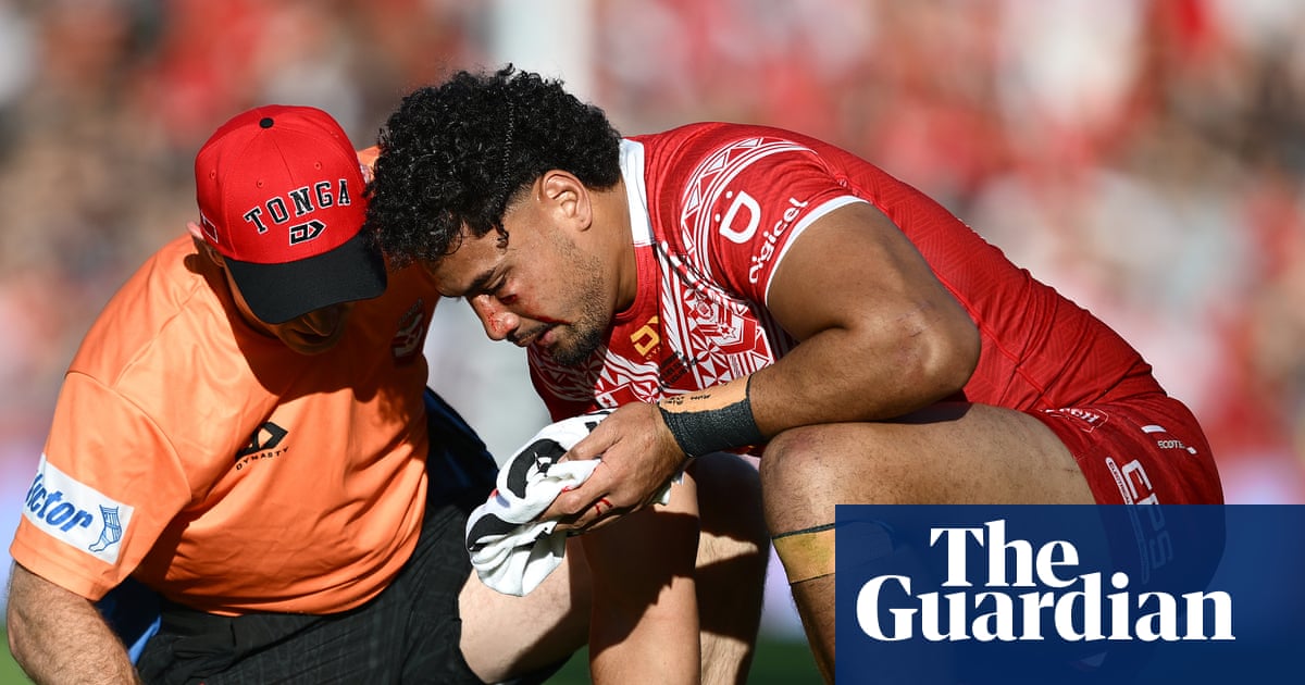 Eli Katoa’s seizure and brain bleed prompts calls for NRL to assess concussion protocols