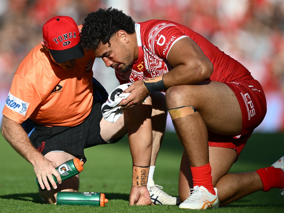 Eli Katoa's seizure and brain bleed prompts calls for NRL to assess concussion protocols | Concussion in sport | The Guardian