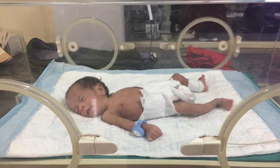 Baby Bracelet Aims To Save Newborns In India From Hypothermia Guardian Sustainable Business The Guardian Baby Bracelet Aims To Save Newborns In India From Hypothermia Guardian Sustainable Business The Guardian