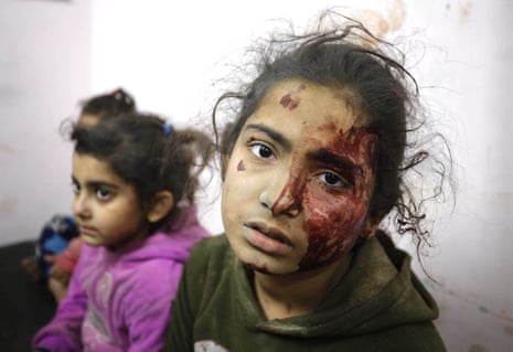 Palestinians injured in an Israeli attack on the Abu Amra family house receive medical treatment at al-Aqsa martyrs hospital in Deir-al-Balah.