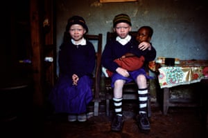 Faraja (8) and Pishon Mhewa (10) with their baby brother Jeminus (6 months). Their parents were both black skinned but carriers of the recessive albinism gene, Tanzania, 2008