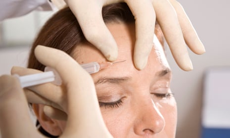 Generic photograph of a woman having an injection in her forehead between the eyes carried out by someone wearing rubber gloves