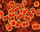 Gonorrhoea and syphilis rise by more than 50% in Australia with ‘concerning’ rise in cases in women