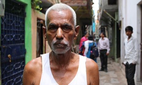 Rammurat, a 25-year-resident of Tahir Pur, who contracted leprosy when he was aged 14. He is one of 2,000 people living with the disease in the east Delhi colonies.