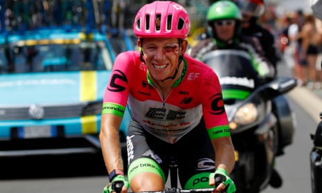 Lawson Craddock was bloodied but unbowed after his crash on the first stage of the Tour de France.