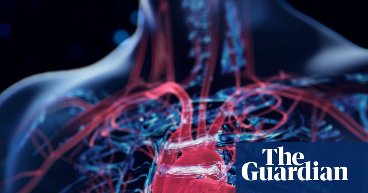 AI Heart Scan: Is This Tech Finna Save Lives or Just Tax Us More?