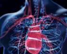 Scientists develop AI tool to spot heart failure risk five years before it strikes