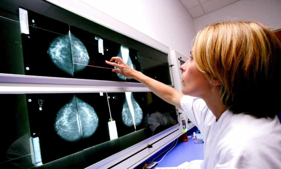 A radiologist examines mammograms: breast cancer diagnoses could almost double by 2030, according to a report in the Lancet.