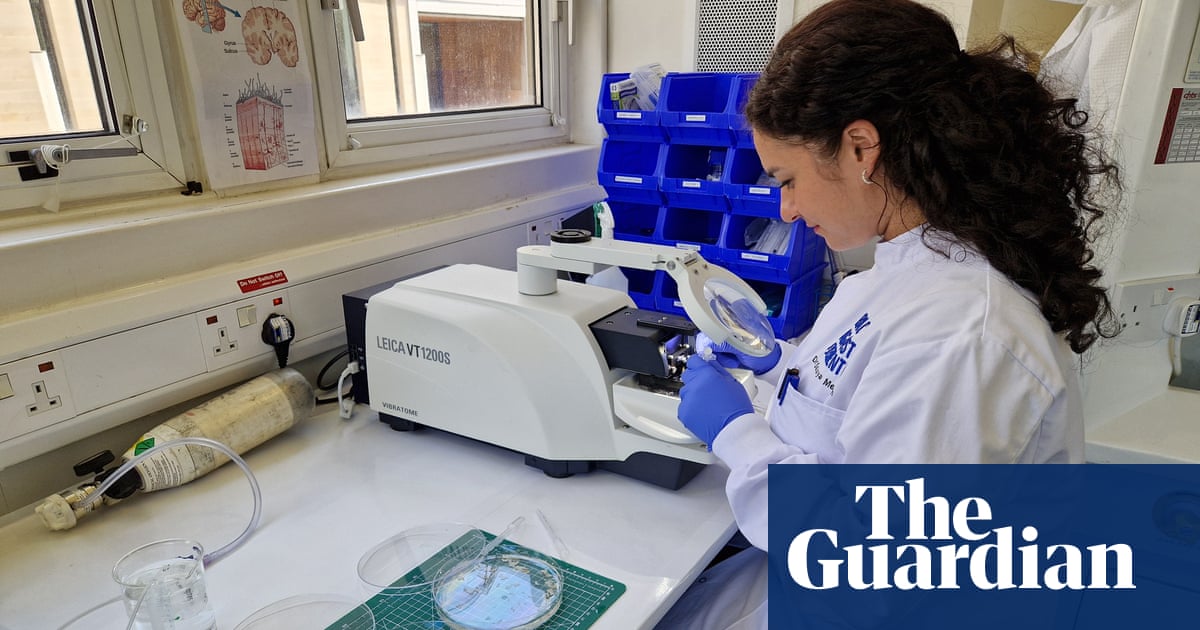 Scientists use live human brain tissue to speed up hunt for dementia cure