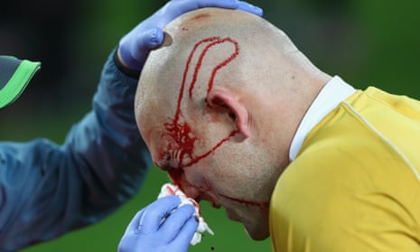 Stephen Moore receives a head wound