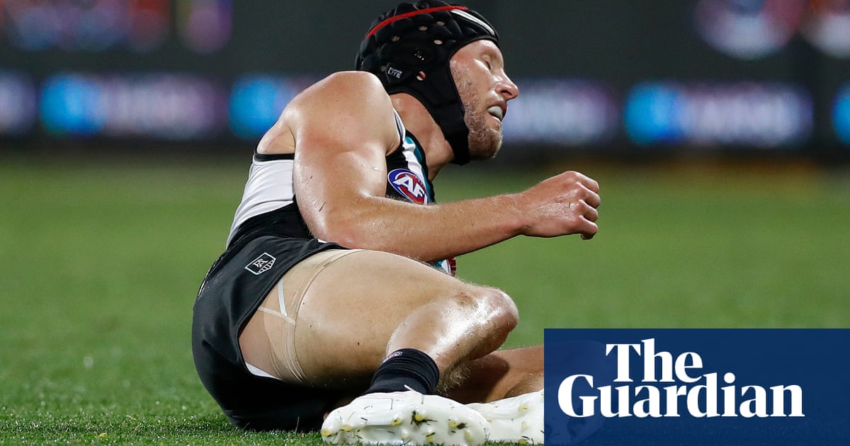 AFL players union to consider multimillion-dollar concussion trust proposal