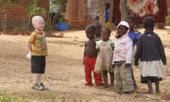 Cassim Jaffalie,3, stands with his friends at their family home in this Monday, May, 23, 2016 photo in Machinga about 200 kilometres north east of Blantyre Malawi.His father Razik Jaffalie gave up his work as a bicycle taxi operator to protect his son in a country where there has been an increase in albinism attacks. At least 18 Albino people have been killed in Malawi in a “steep upsurge in killings” since November 2014, and five others have been abducted and remain missing, a new Amnesty International report released Tuesday, June 7, 2016 says. (AP Photo/Tsvangirayi Mukwazhi)