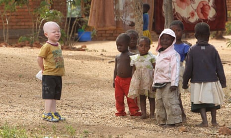 Cassim Jaffalie, three, with his friends at his family home in Machinga, southern Malawi