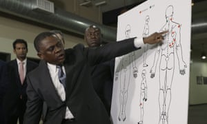 Bennet Omalu gestures to a diagram showing the gunshot wounds he found on the body of Stephon Clark.