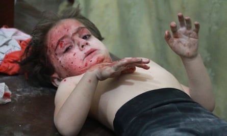 A child wounded in a Russian airstrike, October 2016.