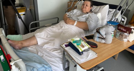 Kay Watkins, before the operation to amputate her second leg