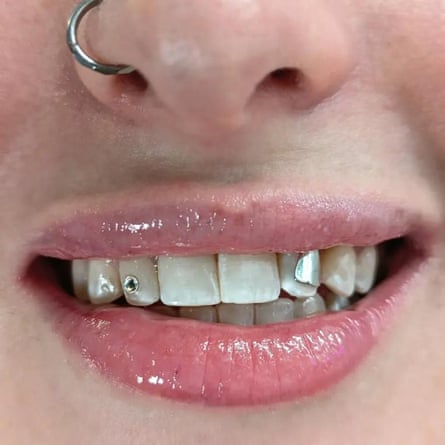 Crystal and silver tooth gems, applied by Ana Mihov.