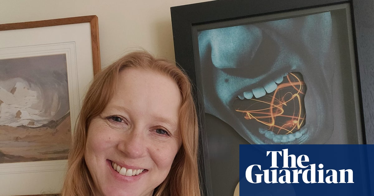 A moment that changed me: My stammer made life a misery – then a song gave me back my voice