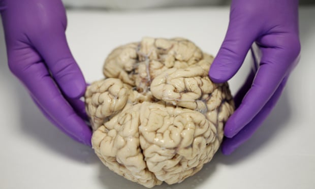 Brain being dissected