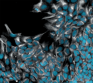 Induced pluripotent stem cells undergoing directed differentiation into early ectoderm.