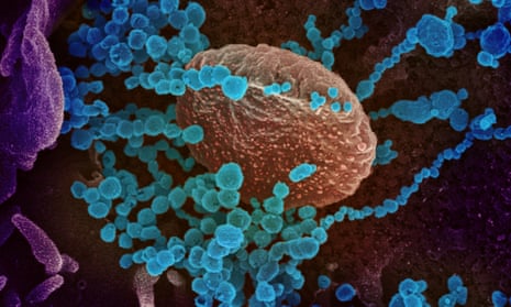 Scanning electron microscope image shows SARS-CoV-2, also known as novel coronavirus